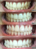 ULTRA WHITENING TEETH STRIPS