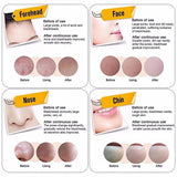 Blackhead Remover Mask, Activated Natural Charcoal Black Mask, Blackhead Peel off Mask, Blackhead & Acne Treatment