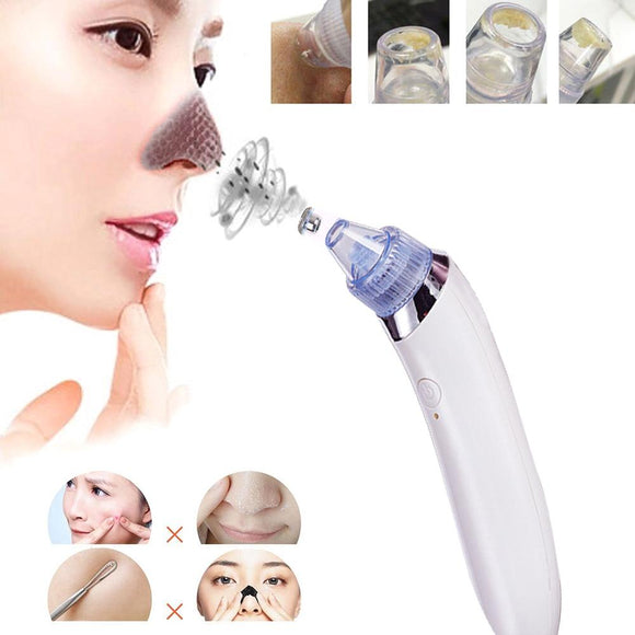 Blackhead Remover Vacuum Pore Cleaner - Electric Pore Vacuum Blackhead