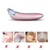Blackhead Remover Vacuum Pore Cleaner - Electric Pore Vacuum Blackhead